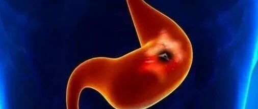 常见胃肠病应遵循的食养原则