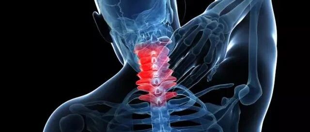 颈椎病的十个等级，你在哪一级？