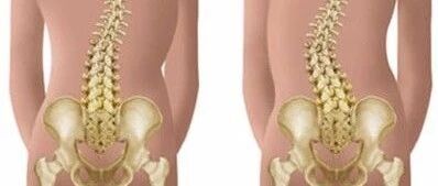 腰椎间盘突出是“睡”出来的？别慌，这有7个窍门帮你护腰