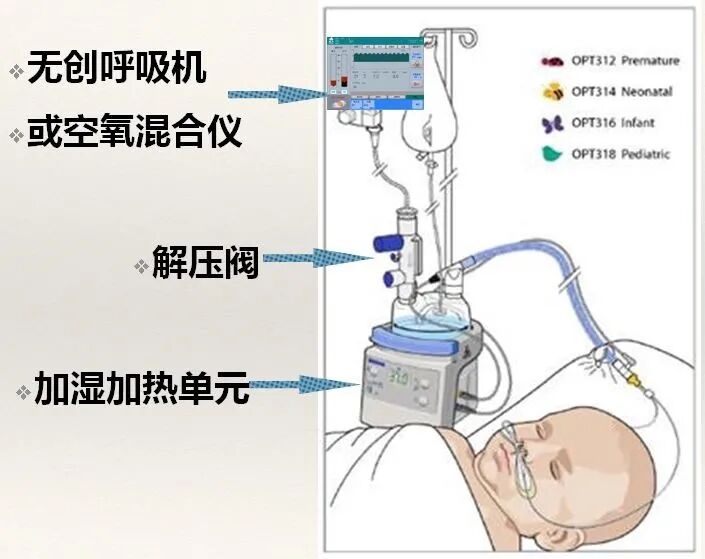 儿科CPAP为什么镇静中儿讲座161：新生儿呼吸管理的基础_https://www.jmylbn.com_新闻资讯_第4张