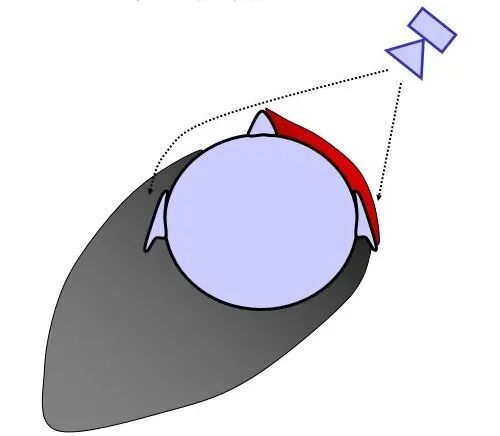 助听器只戴一只行不可？当心另一侧耳朵退化！4