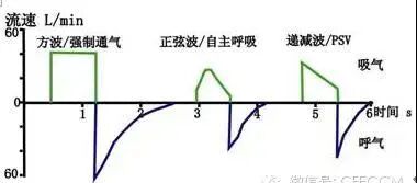 呼吸机f指什么常见呼吸机波形！_https://www.jmylbn.com_新闻资讯_第7张