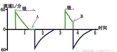 呼吸机f指什么常见呼吸机波形！_https://www.jmylbn.com_新闻资讯_第9张