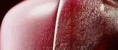 身体这4个地方发红, 说明你是长寿体质, 哪怕只占一个!