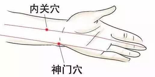 神门.jpg 图片