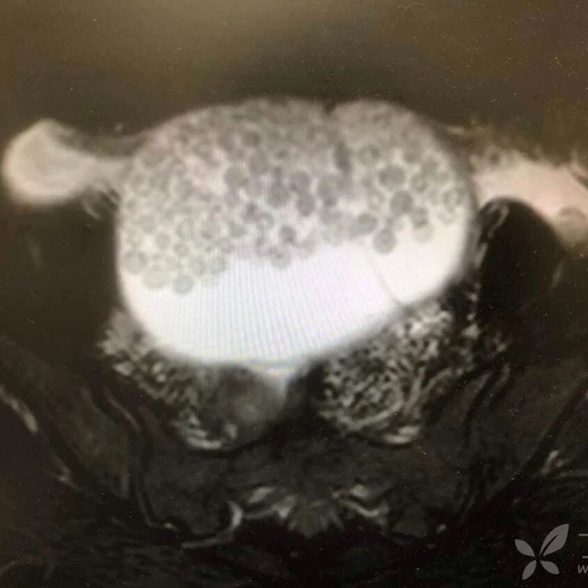 腹腔满满都是「奶茶珍珠」，猜猜是什么？