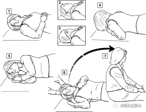水平半规管bppv——复位_医学界-助力医生临床决策和职业成长