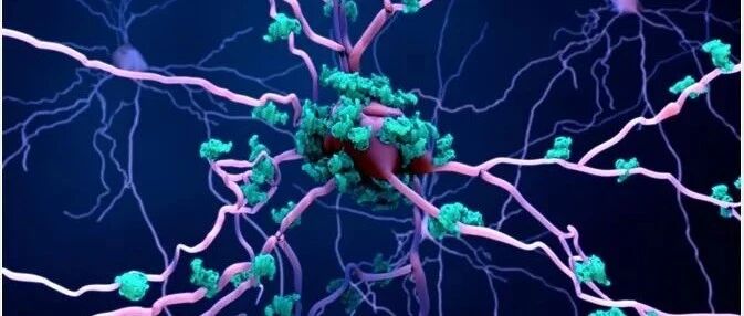 炎症标志物在阿尔茨海默病早期已很明显