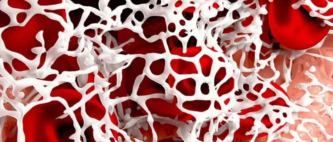 纤维蛋白原直接与神经细胞相互作用，引起脑炎症