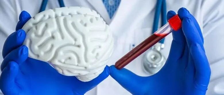 大型国际研究中阿尔茨海默病的血液检测高度准确