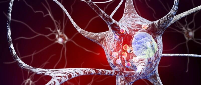 睡眠和麻醉期间大脑活动的不稳定性是阿尔茨海默病的病理生物学基础