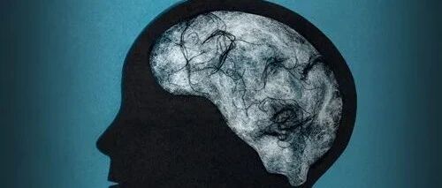 “脑雾”：在新冠肺炎患者的大脑中发现了类似阿尔茨海默病的变化