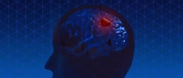 研究现在将非突变的ApoE与失智联系起来