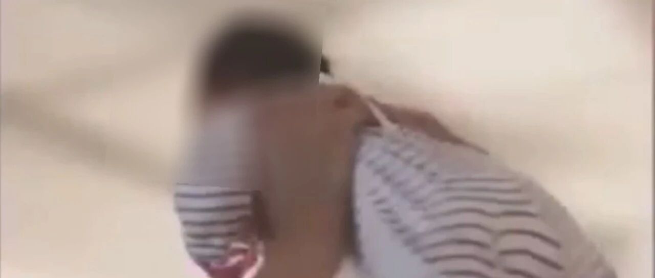 爸爸“举高高”，失手将儿子摔致颅脑损伤！恐成植物人…