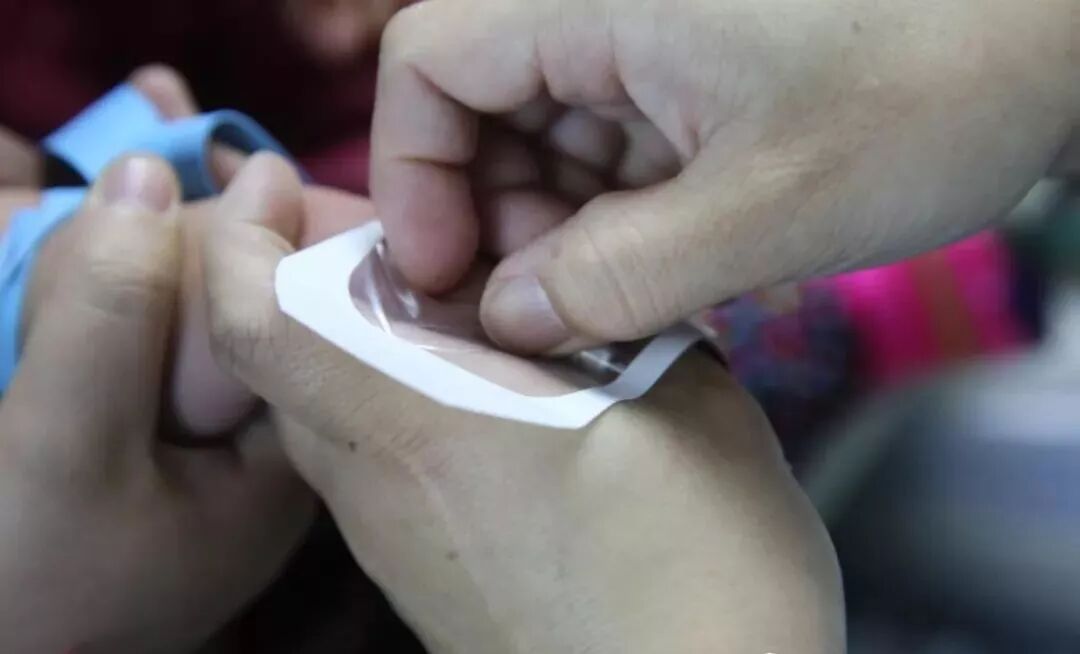 留置针怎么单手推针留置针单手送管法，提高成功率，你get了吗？(内附视频)_https://www.jmylbn.com_新闻资讯_第5张