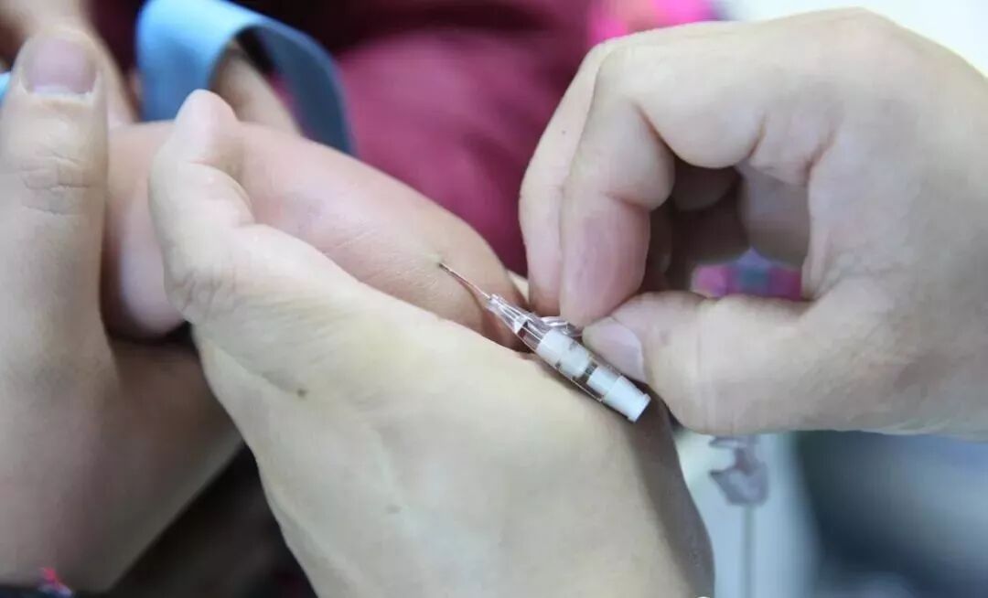 留置针怎么单手推针留置针单手送管法，提高成功率，你get了吗？_https://www.jmylbn.com_新闻资讯_第4张