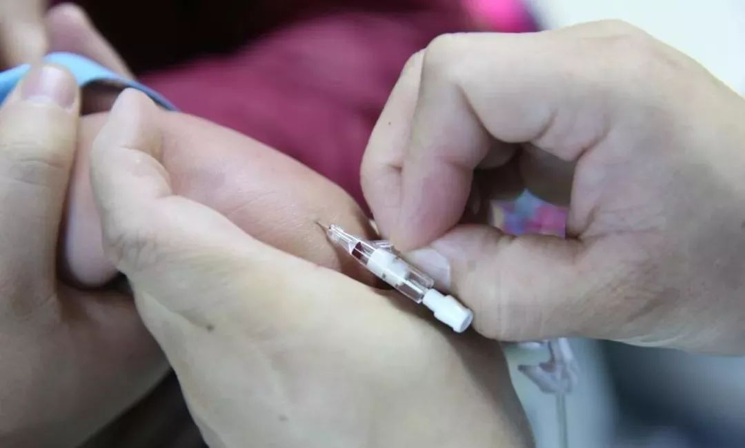 留置针怎么单手推针留置针单手送管法，提高成功率，你get了吗？(内附视频)_https://www.jmylbn.com_新闻资讯_第3张