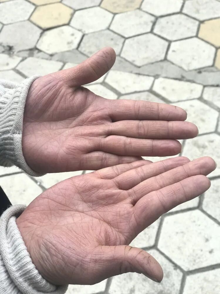 通知！石家庄已近1个小孩Saverdun！全省数处多发！(图6)