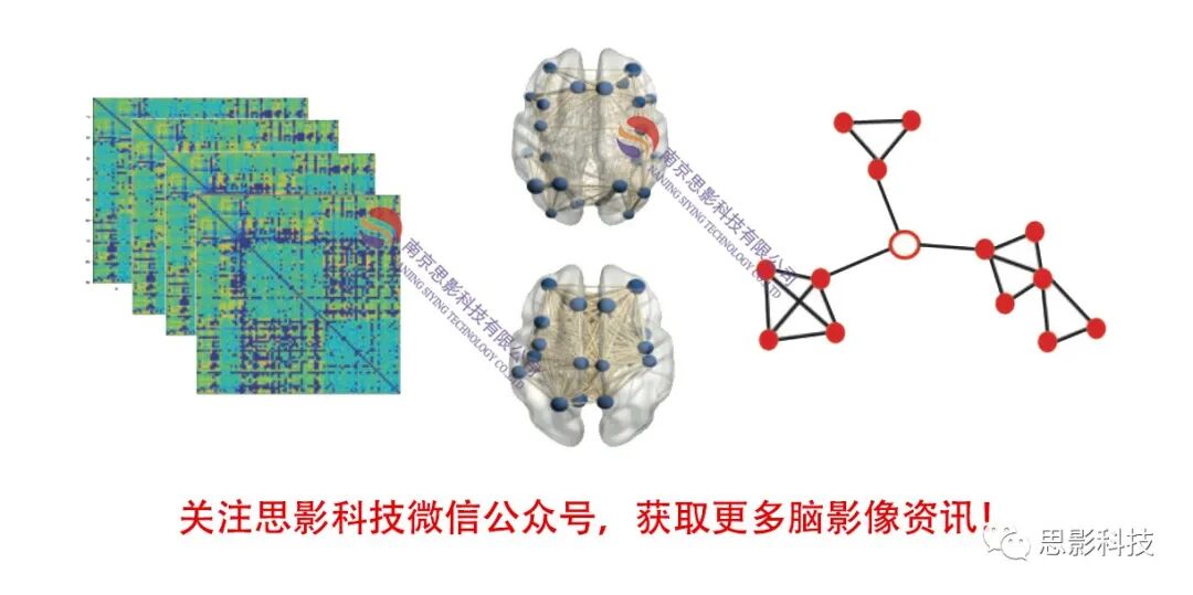 第十七届磁共振脑网络数据处理班 重庆 10 20 25 思影科技 微信公众号文章阅读 Wemp