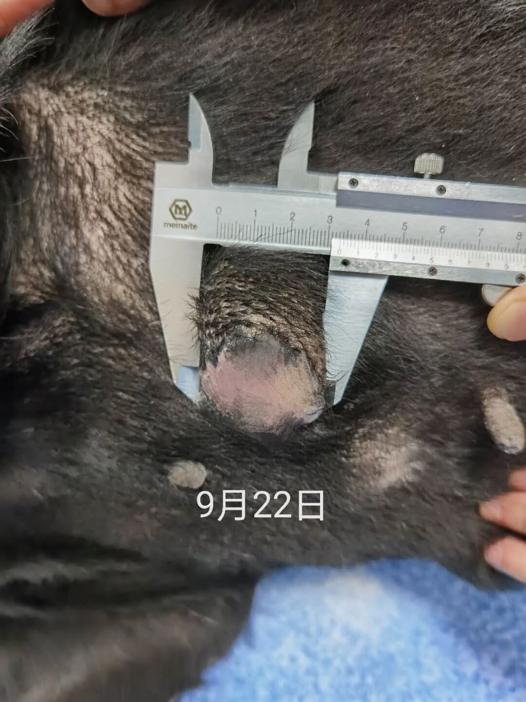 氩氦刀 浙江芭比堂 国内新闻