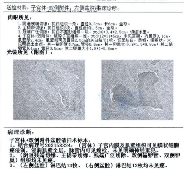 『安e术』——子宫颈癌残端广泛手术（剪辑版）