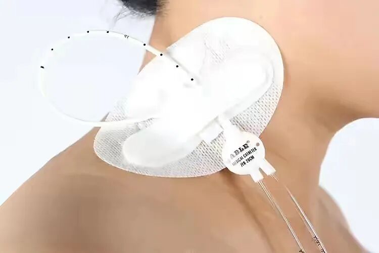 中心导管怎么使用科普｜关于中心静脉导管，您了解多少？_https://www.jmylbn.com_新闻资讯_第9张