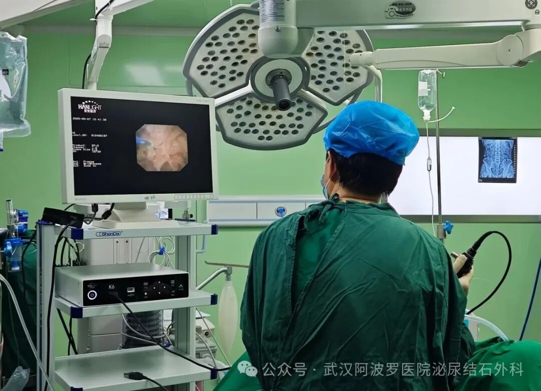 【红色医疗 全心服务】我院泌尿外科结石II病区正式投入使用