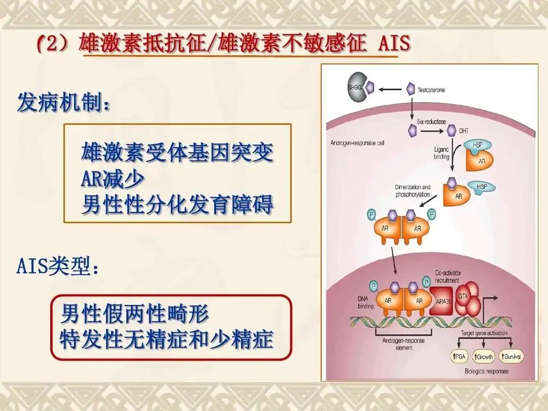 最常见者为ar缺陷所致的睾丸女性化综合征