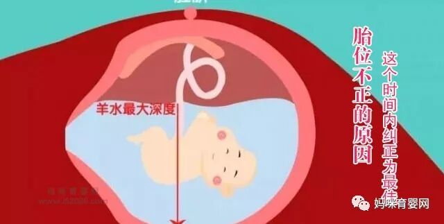 胎位不正的原因 这个时间内纠正为最佳