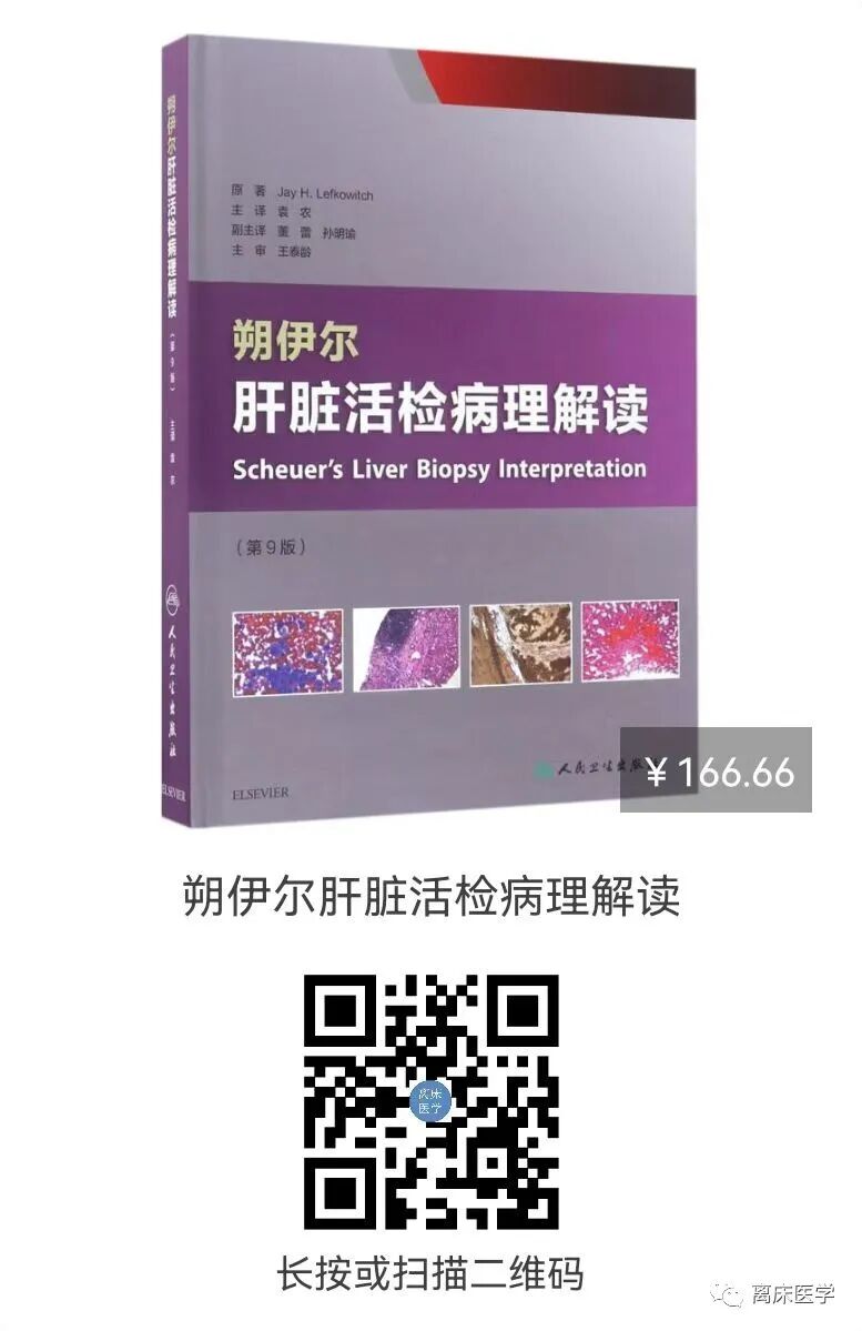 g穿刺怎么玩穿刺针上的G、mm是啥？尺寸的计算公式是？_https://www.jmylbn.com_新闻资讯_第12张