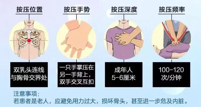 心肺复苏怎么数数字“1001，1002，1003……”是代表心肺复苏按压了1000多次吗？_https://www.jmylbn.com_新闻资讯_第9张
