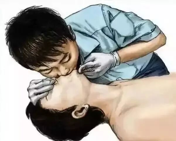 心肺复苏怎么数数字“1001，1002，1003……”是代表心肺复苏按压了1000多次吗？_https://www.jmylbn.com_新闻资讯_第13张