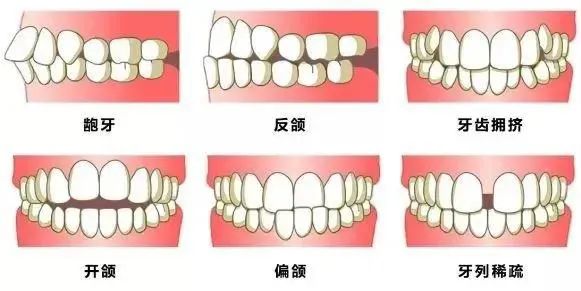 天津人注意！2020年看牙補貼新調整，最高補貼2000元，不限戶籍！ 健康 第8張