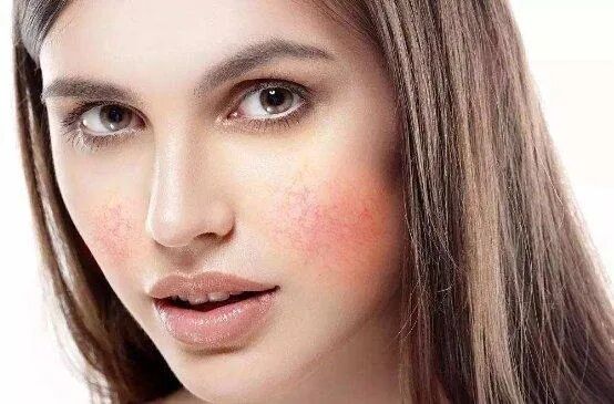 夏天猛吹空调肌肤问题频出该怎么办