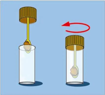 化验大便怎么采集大便化验，如何正确收集标本？_https://www.jmylbn.com_新闻资讯_第2张