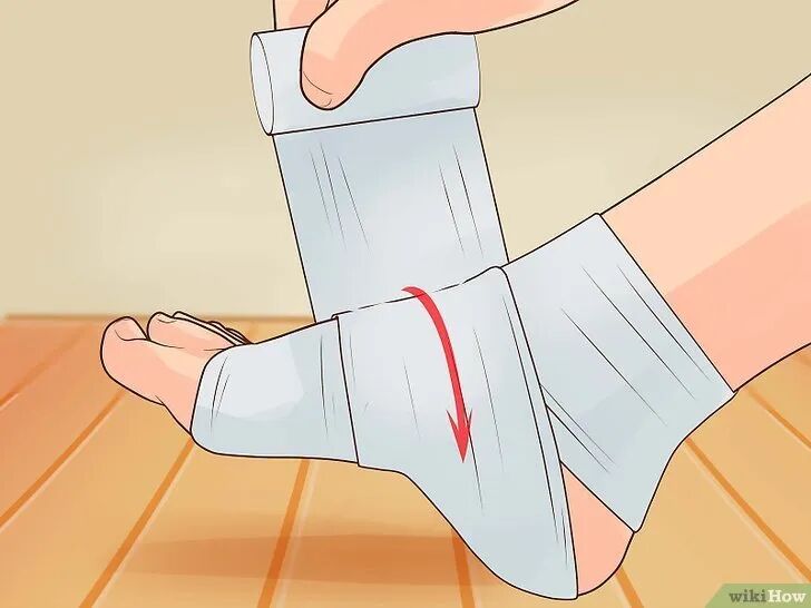 医用绷带怎么绑图解爱运动的青年看过来，这是你需要掌握的踝关节扭伤弹力绷带包扎方法（附视频演示）_https://www.jmylbn.com_新闻资讯_第6张