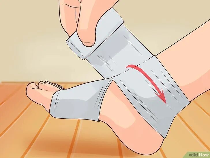 医用绷带怎么绑图解爱运动的青年看过来，这是你需要掌握的踝关节扭伤弹力绷带包扎方法（附视频演示）_https://www.jmylbn.com_新闻资讯_第7张