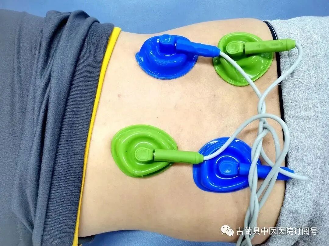 中频为什么能镇痛【康复讲堂】解痉“神器”，疼痛“克星”——中频电疗仪_https://www.jmylbn.com_新闻资讯_第7张