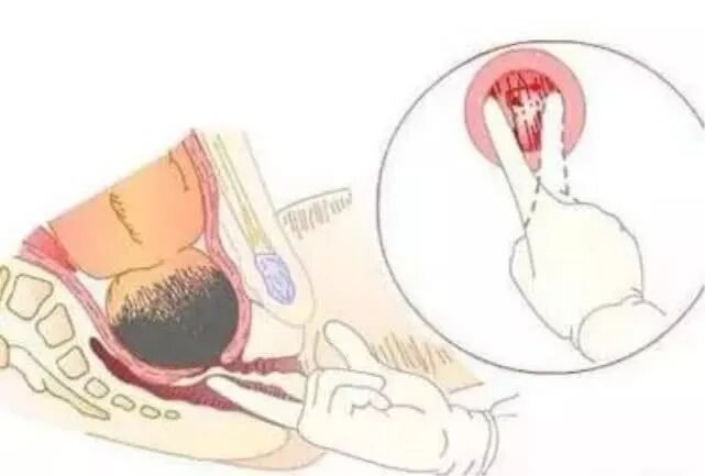 产房里的尴尬事，只有当妈妈的才懂！宝妈们有同感吗？