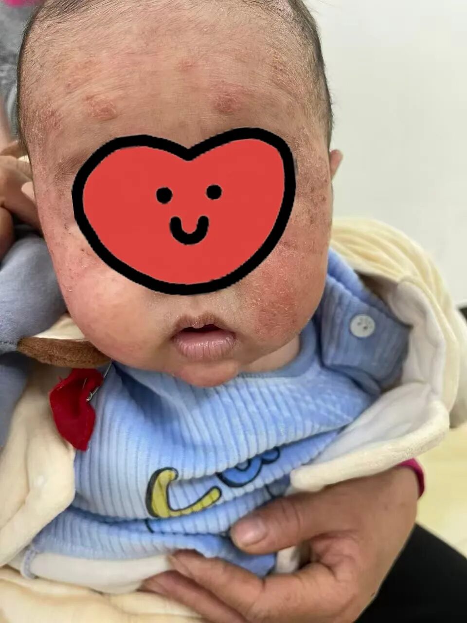 康复治疗激光怎么收费新增特色诊疗服务，守护健康更有温度！我院儿科急诊24小时服务全新上线！_https://www.jmylbn.com_新闻资讯_第18张