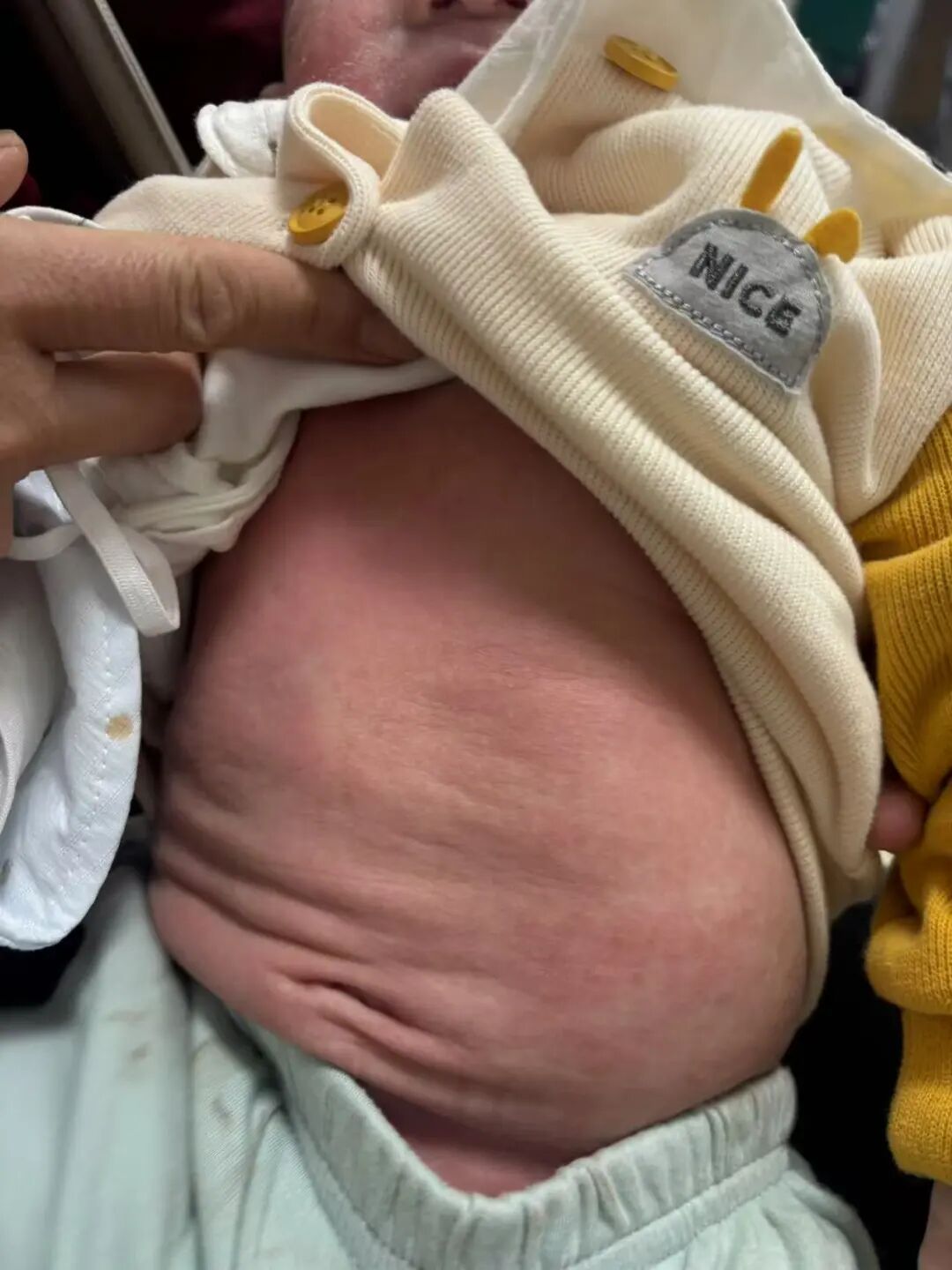 康复治疗激光怎么收费新增特色诊疗服务，守护健康更有温度！我院儿科急诊24小时服务全新上线！_https://www.jmylbn.com_新闻资讯_第16张