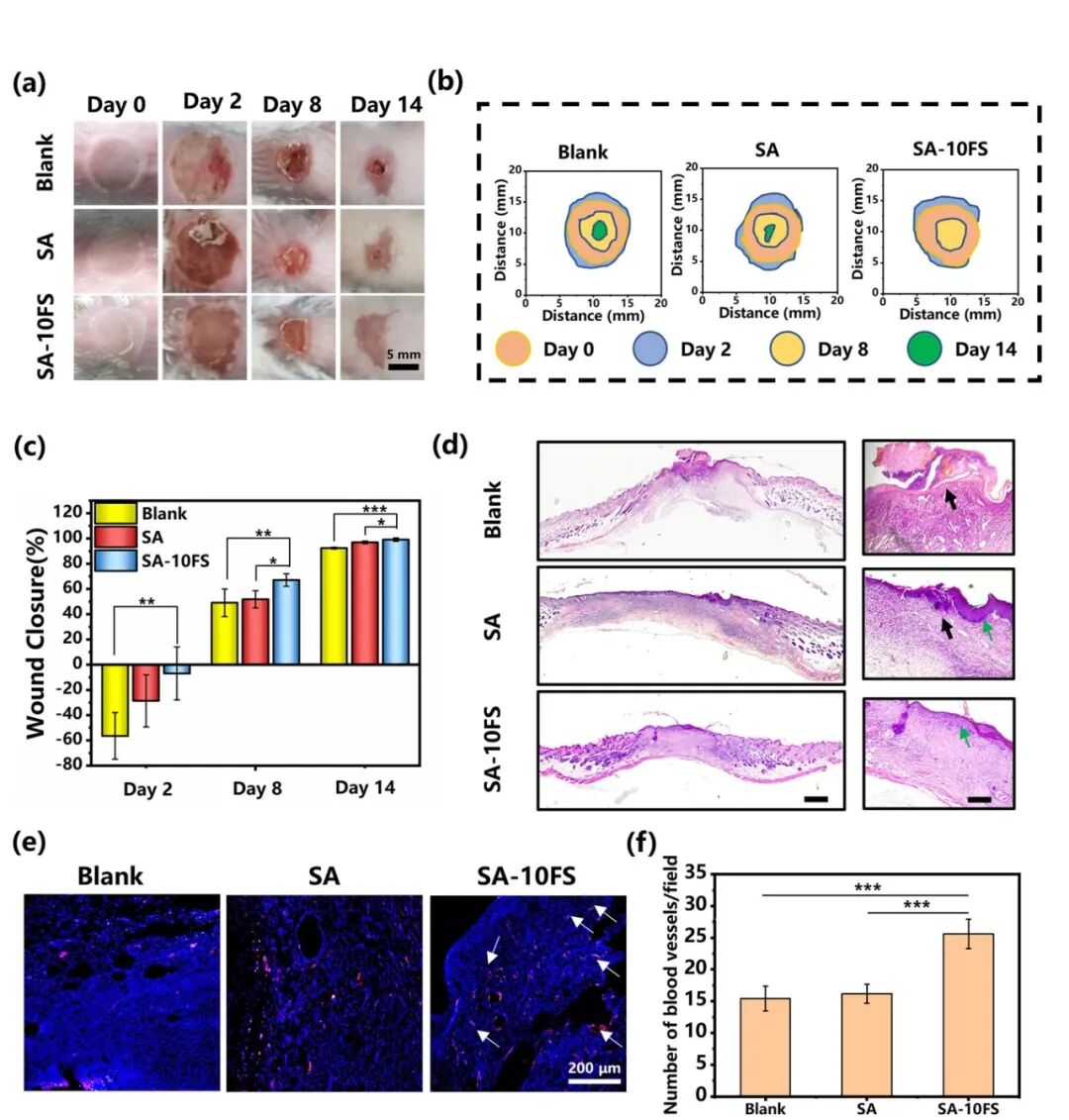 中科院上海硅酸鹽所吳成鐵研究員團(tuán)隊(duì)Biomaterials：噴霧式β-FeSi2 復(fù)合水凝膠用于便攜式皮膚腫瘤治療和創(chuàng)面愈合的圖3