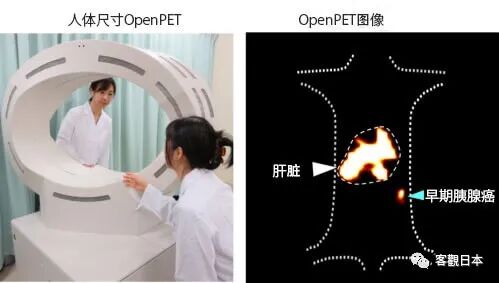 日本成功开发出微小胰腺癌图像诊断法，可确诊1cm以下早期癌症
