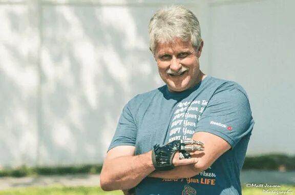 手部假肢公司通过金属3D打印扩大制造规模，3D Systems应用案例的图3