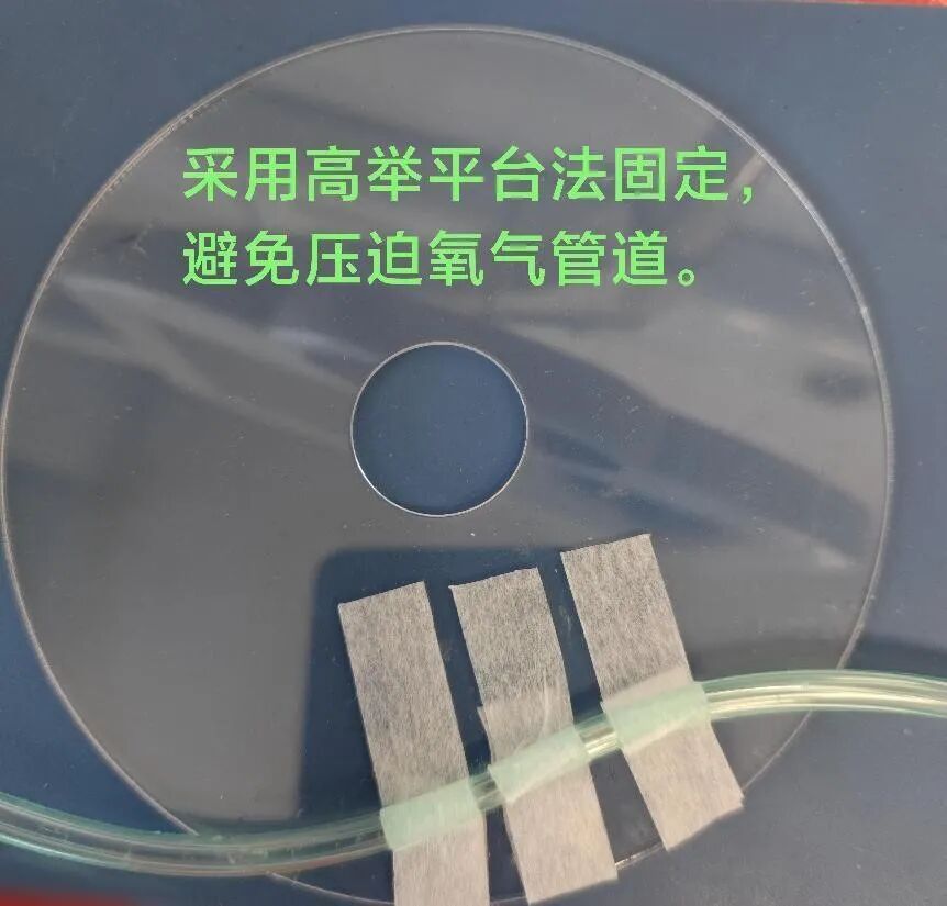 为什么医院的氧气好氧气管道不好固定？负压引流不能及时倾倒？看看别人医院的小发明，提高便捷度～_https://www.jmylbn.com_新闻资讯_第6张