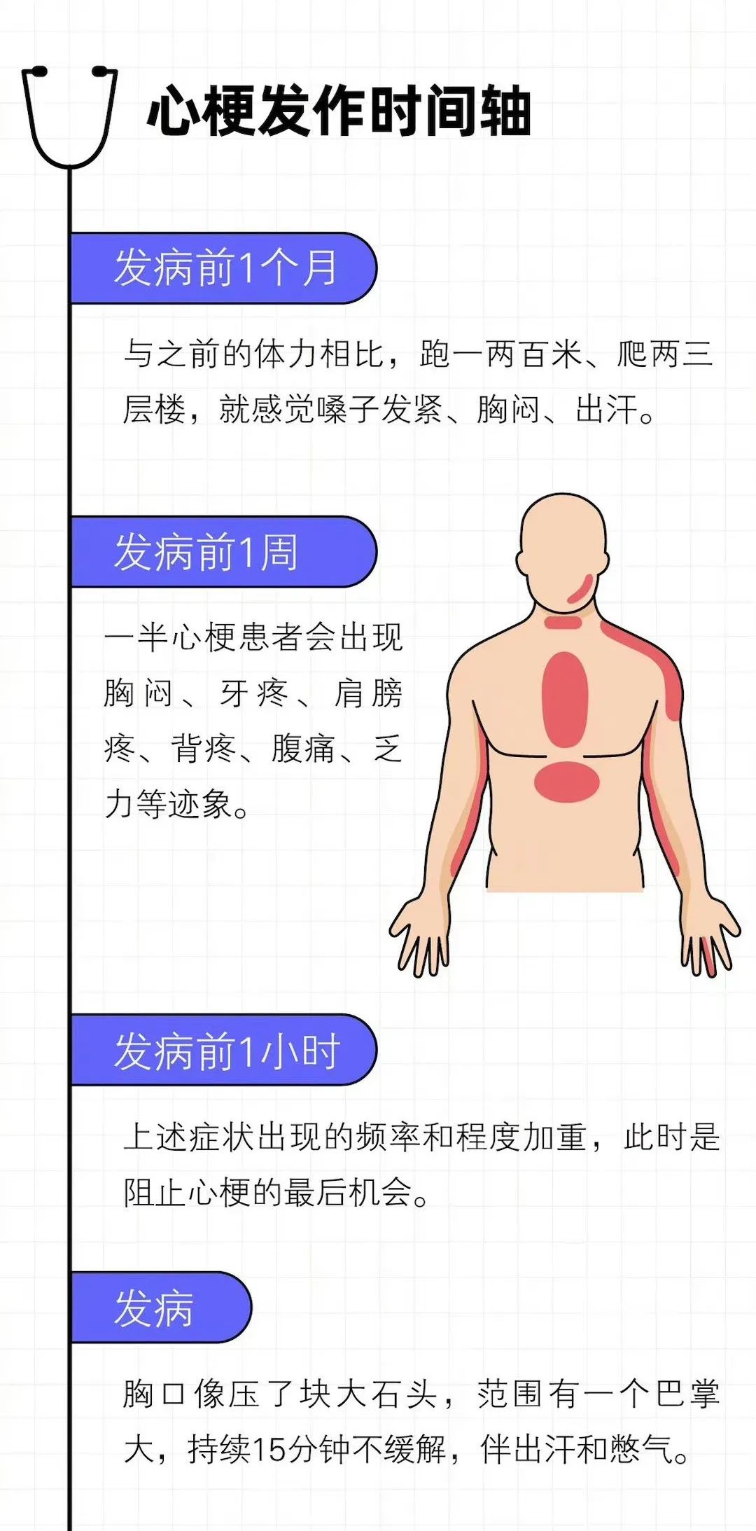 急性心肌梗死如何快速高效急救？