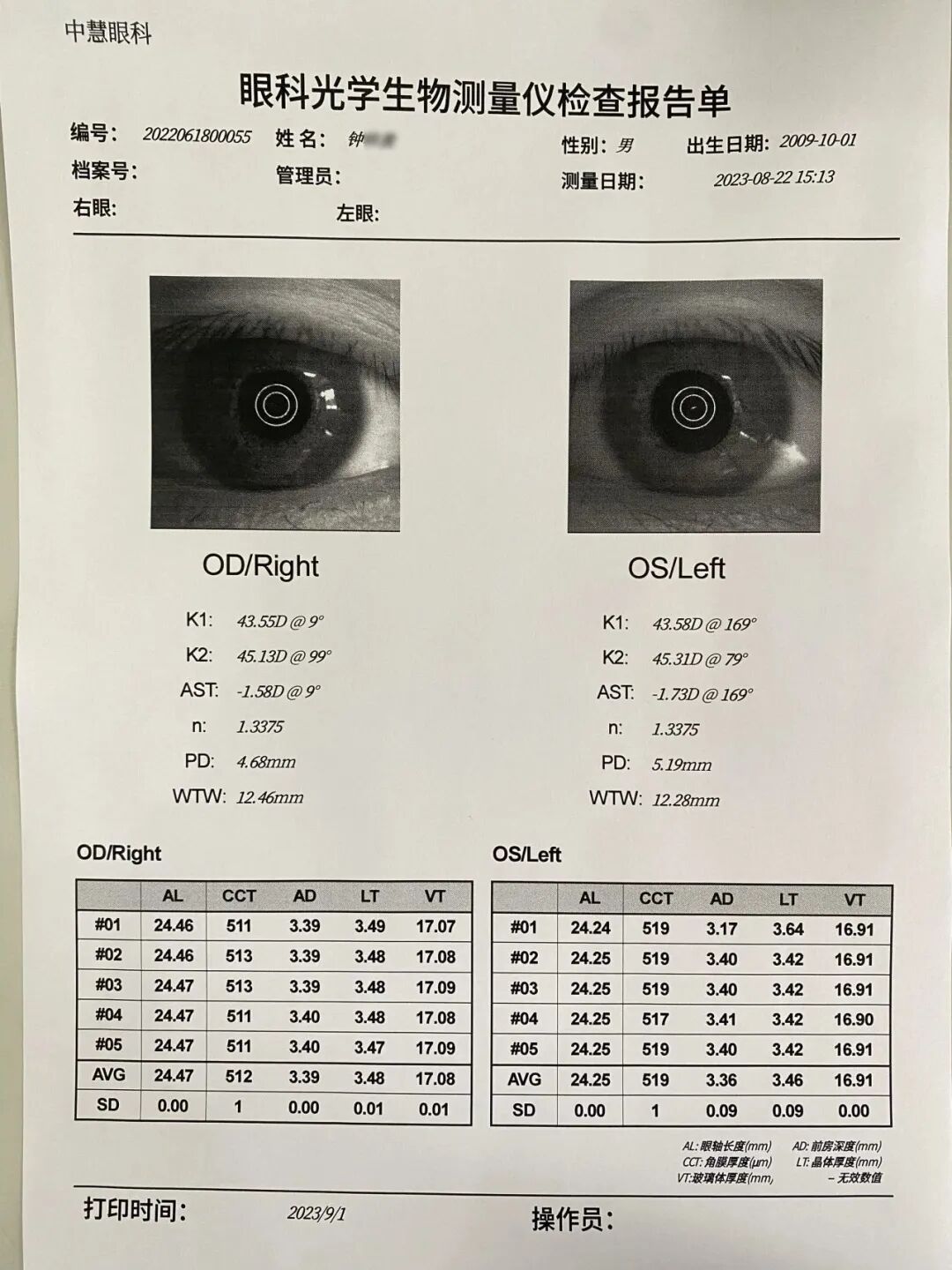 眼科生物测量仪怎么看视力无增长案例  ▏教你如何掌握生物测量的8组数据_https://www.jmylbn.com_新闻资讯_第3张