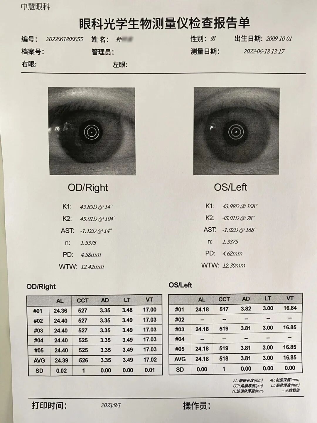 眼科生物测量仪怎么看视力无增长案例  ▏教你如何掌握生物测量的8组数据_https://www.jmylbn.com_新闻资讯_第2张