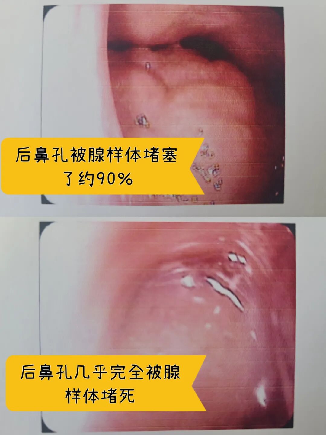 北京东区儿童医院