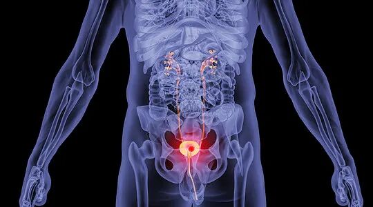 b膀胱镜为什么消毒博鳌首例一次性电子膀胱镜落地，膀胱肿瘤检查迎来新选择_https://www.jmylbn.com_新闻资讯_第2张